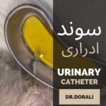 سوند ادراری