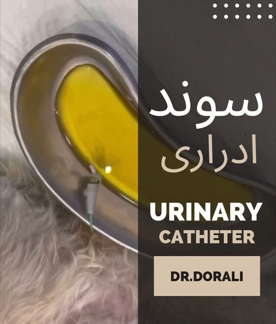 سوند ادراری