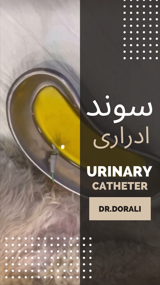 سوند ادراری